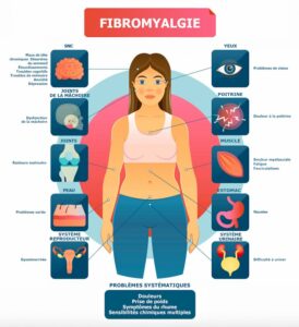 CBD fibriomalgie symptomes