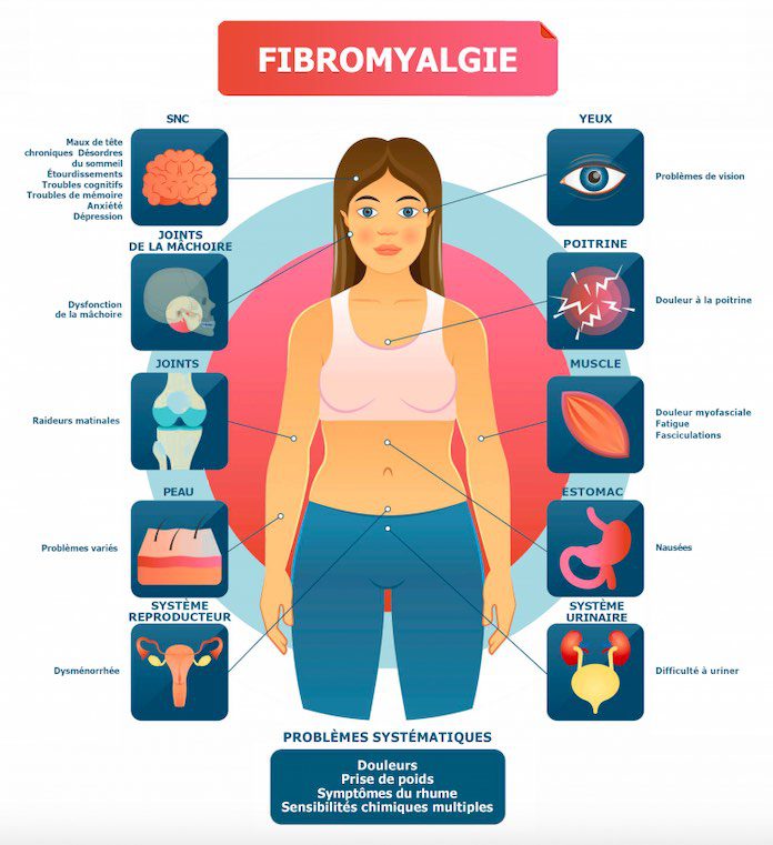 CBD fibriomalgie symptomes